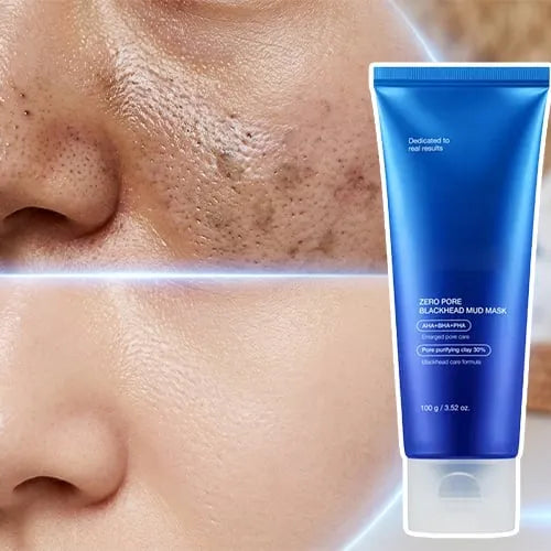 Ultimate Blackhead Care Mud Mask